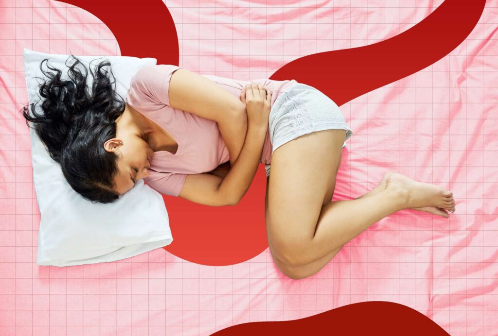 Some Dietary Changes May Help with Endometriosis
